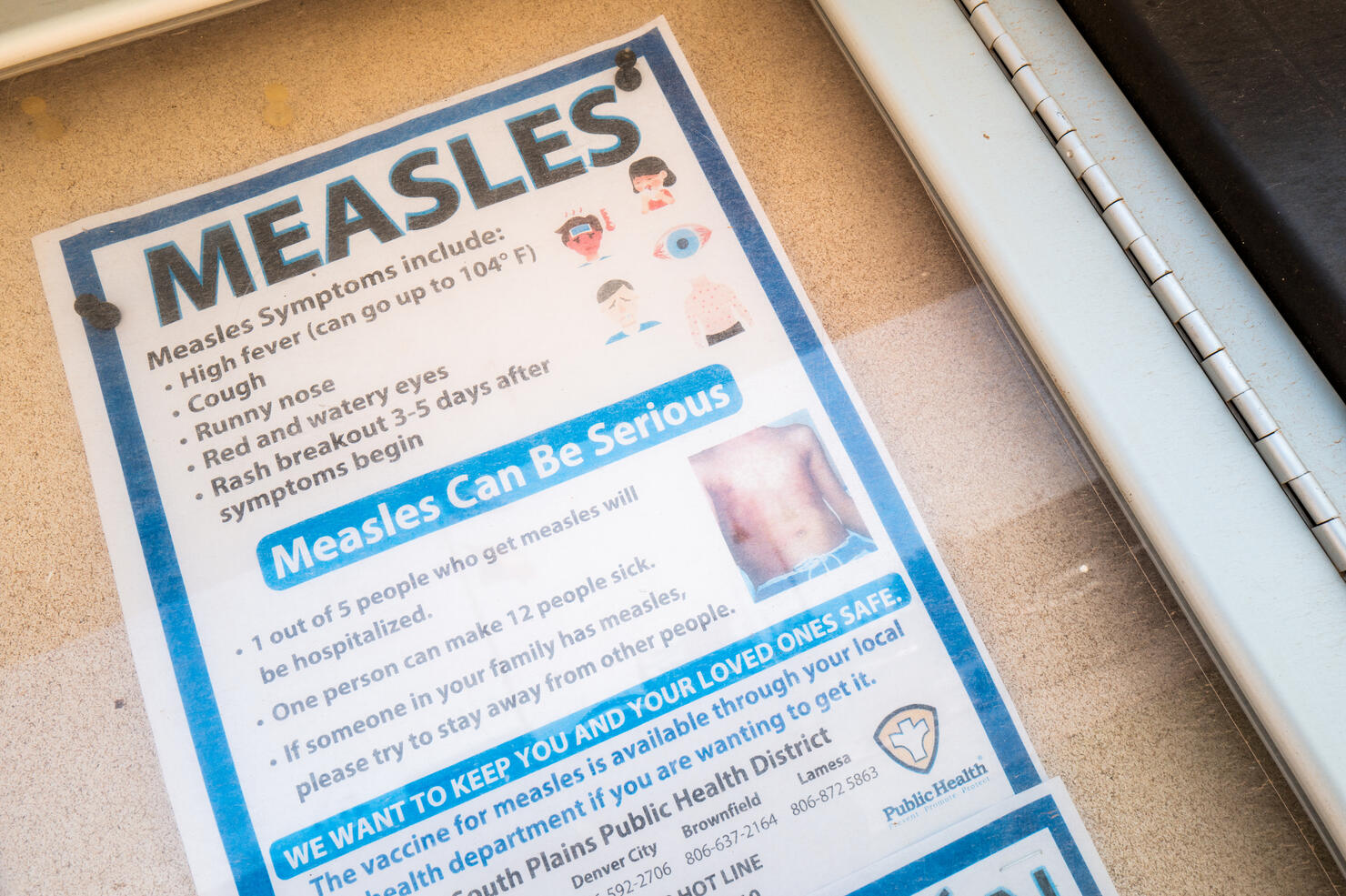 Second Child Dies As Measles Outbreak Continues To Spread In Texas