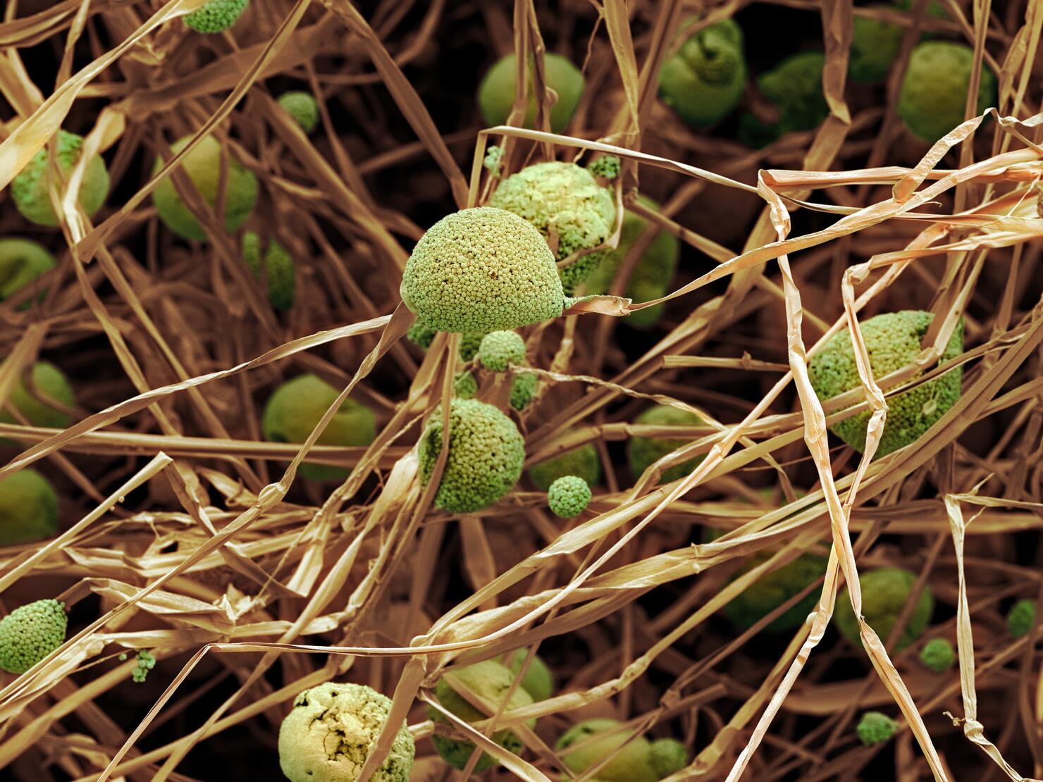 Fungal cells, SEM