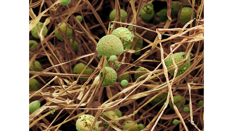 Fungal cells, SEM