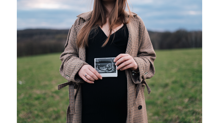 Young parents are waiting for their baby,Poland