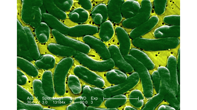Vibrio vulnificus