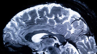 FAU First to Combine MRI with Ultrasound Technologies 