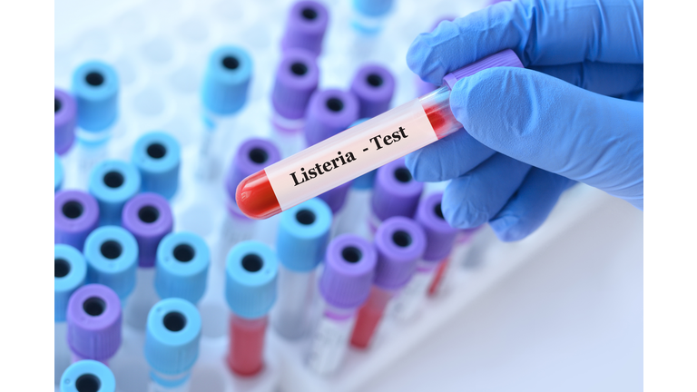 Doctor holding a test blood sample tube with Listeria bacteria test on the background of medical test tubes with analyzes
