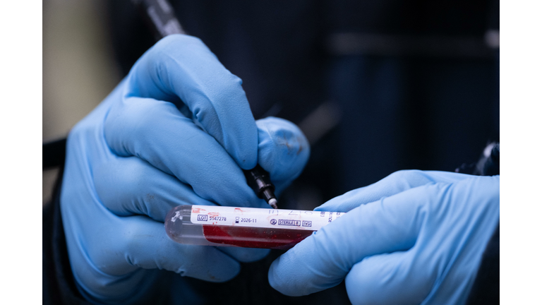 FRANCE-HEALTH-VIRUS-ANIMAL