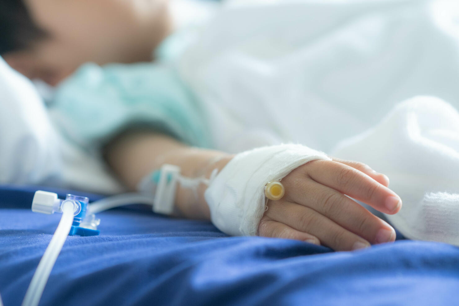 Asian todler in hospital with intravenous saline. Sick children, infected with the virus, are lying and being treated in beds in hospitals.