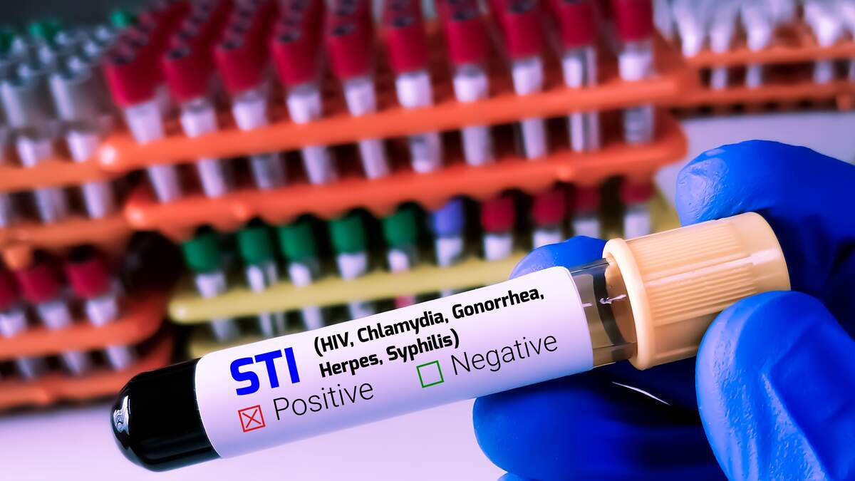 Louisiana Incurable STI Task Force Starts Working On Annual Report