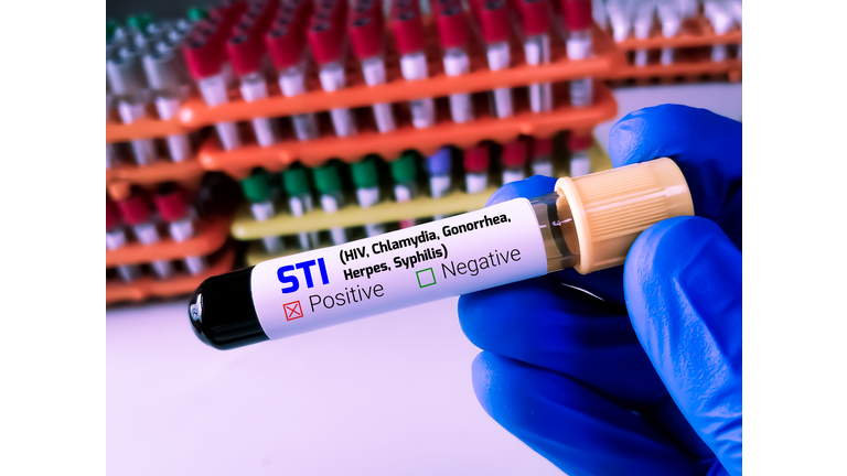 Biochemist or Lab Technologist holds Blood sample for STI or Sexually Transmitted Infection Test with laboratory background.
