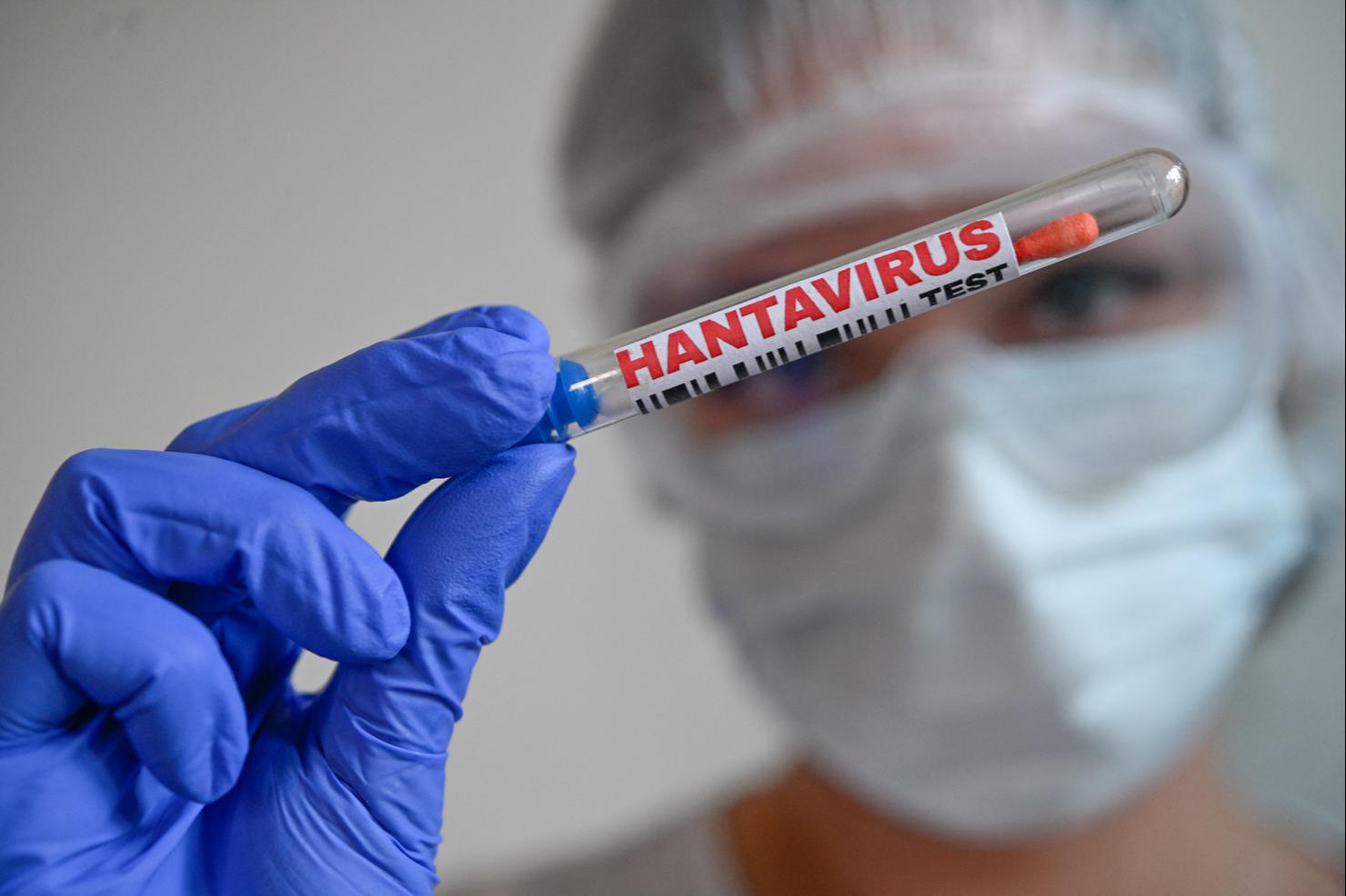 FRANCE-ILLUSTRATION-HANTAVIRUS-TESTING