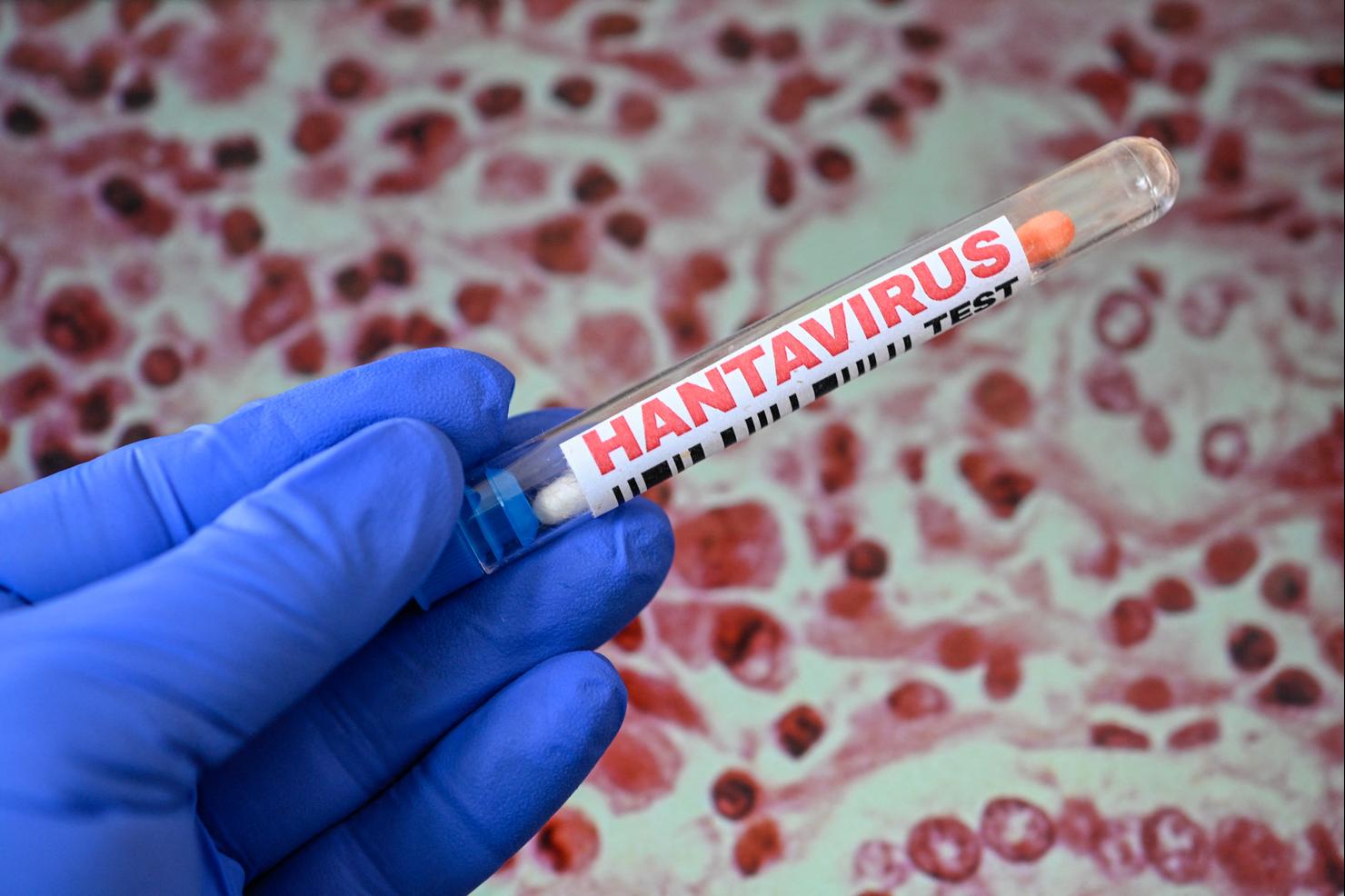 FRANCE-ILLUSTRATION-HANTAVIRUS-TESTING