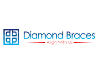 Diamond Braces