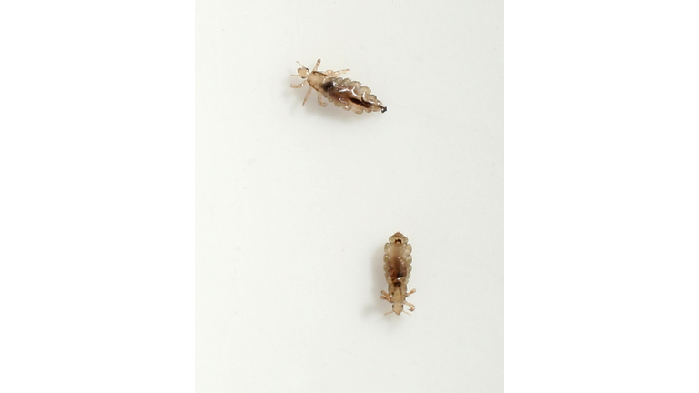 Common Head Lice