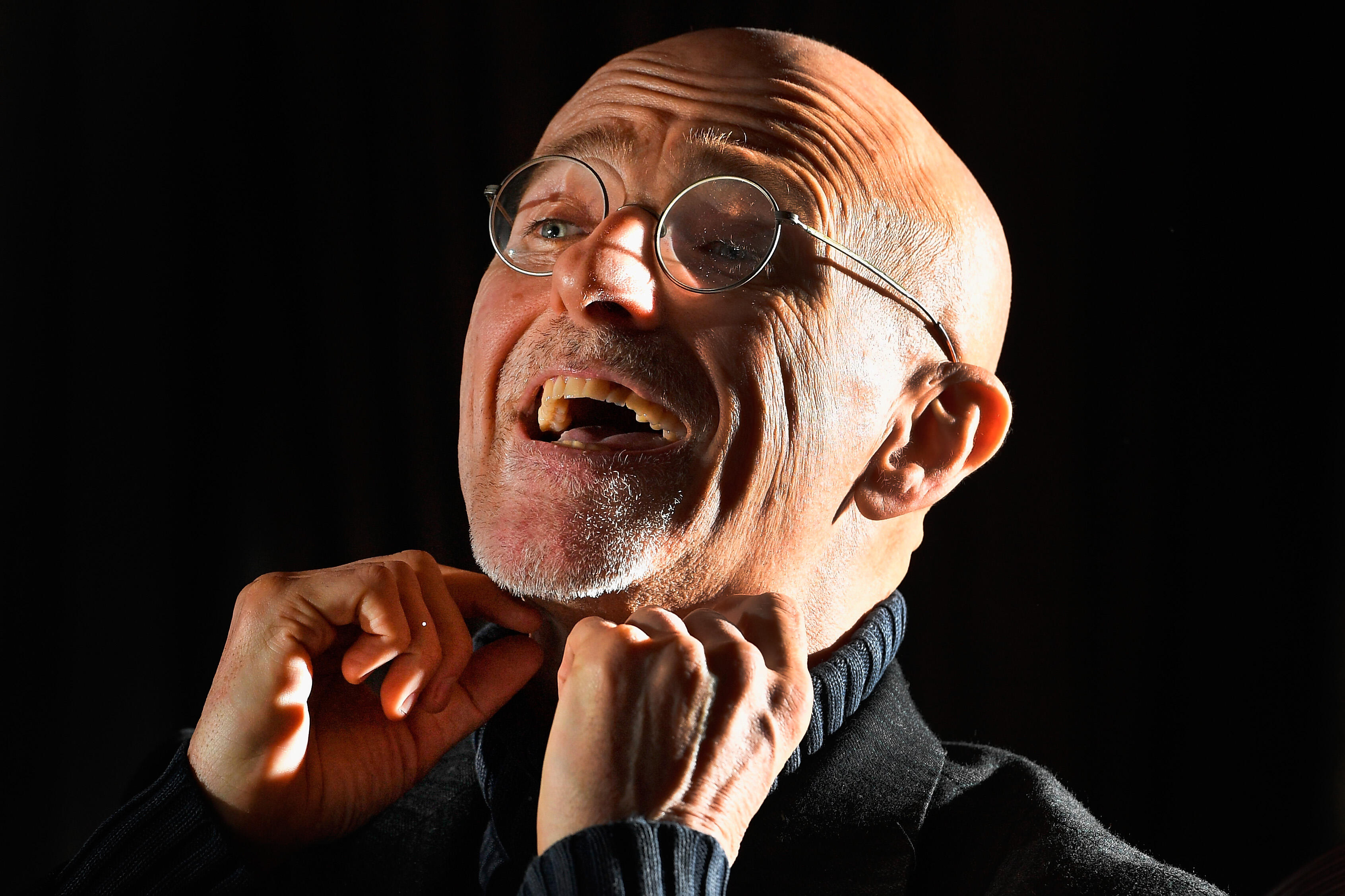 Neurosurgeon Sergio Canavero is set to announce more details about his controversial head transplant surgery...