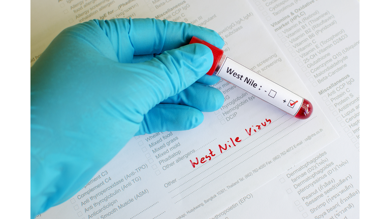 West Nile positive