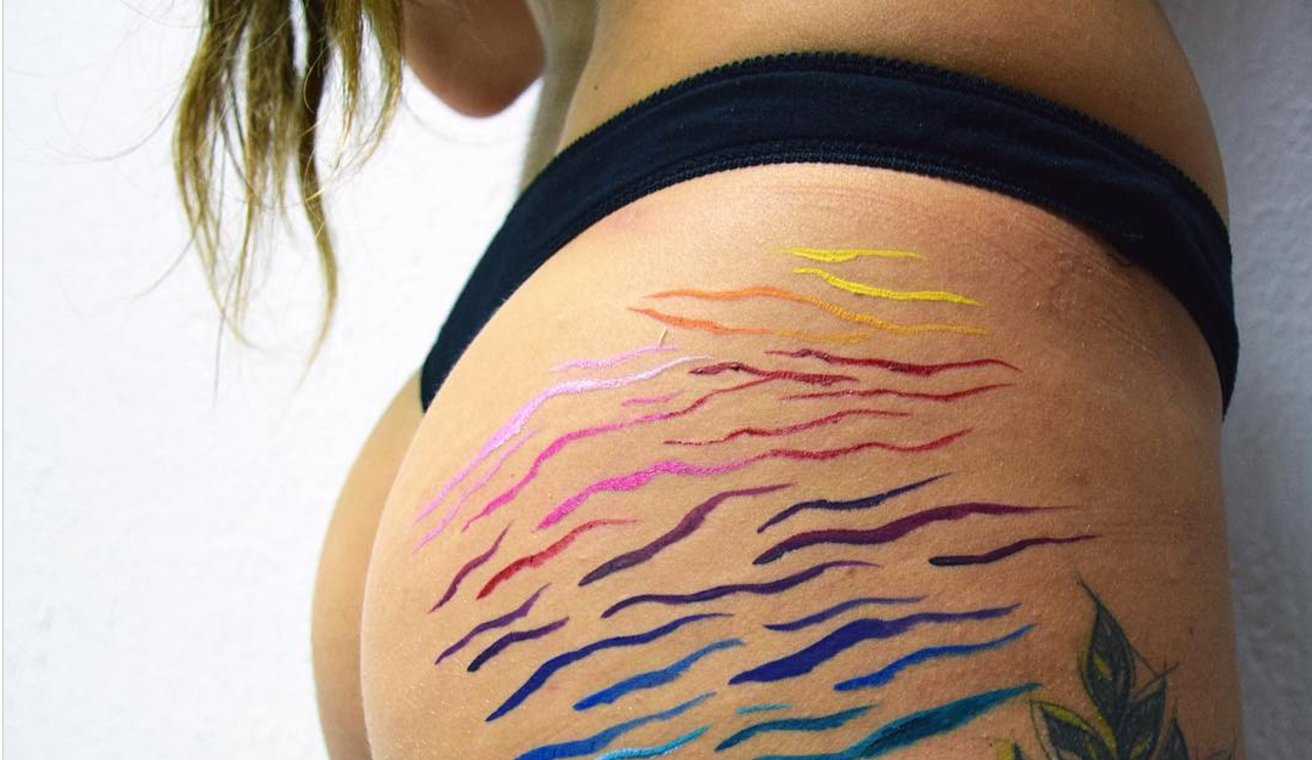 Artist Turns Stretch Marks Into Beautiful Masterpieces iHeart.