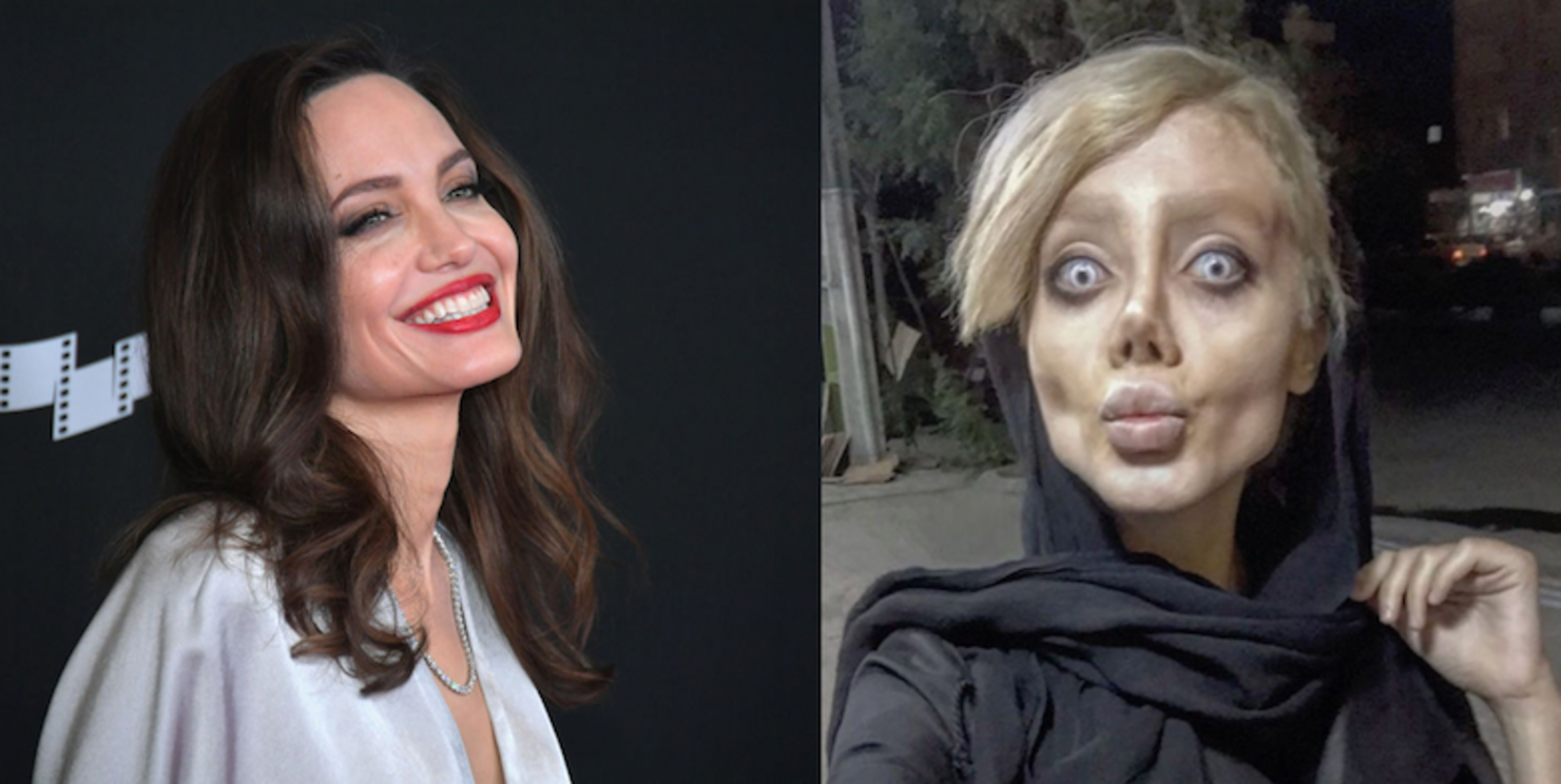 Woman Has Had 50 Surgeries To Look Like Angelina Jolie | iHeart