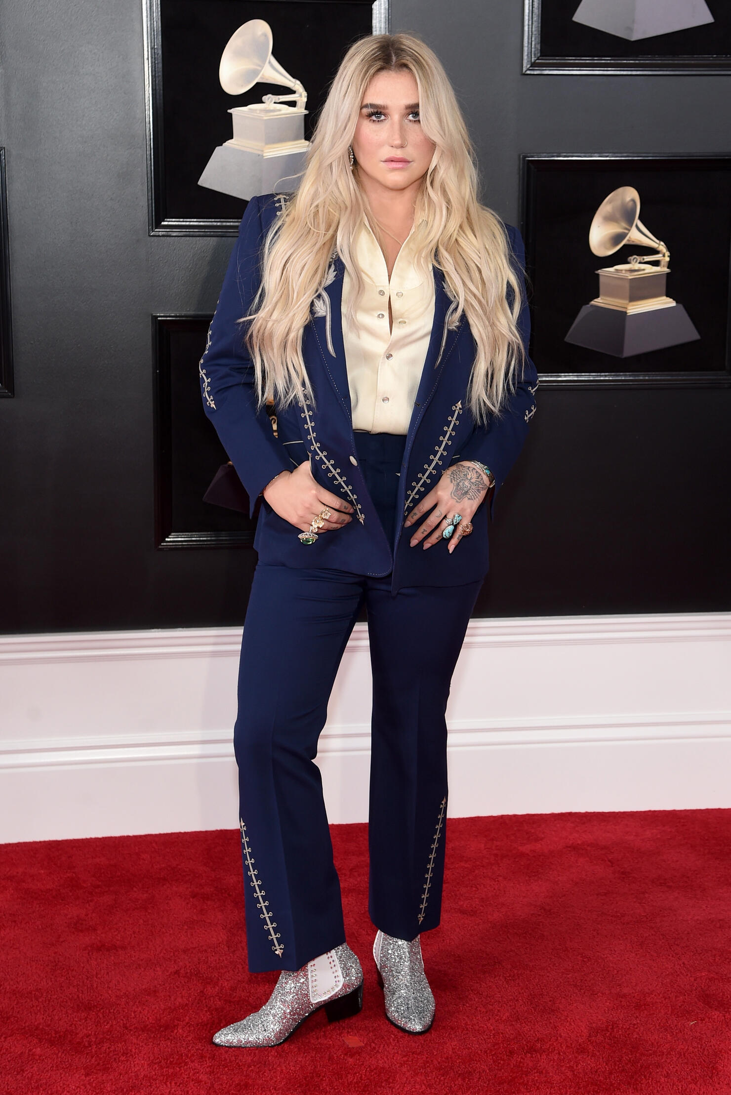 Kesha (Getty Images)