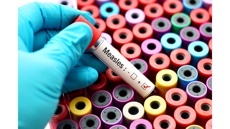 Measles Getty RF
