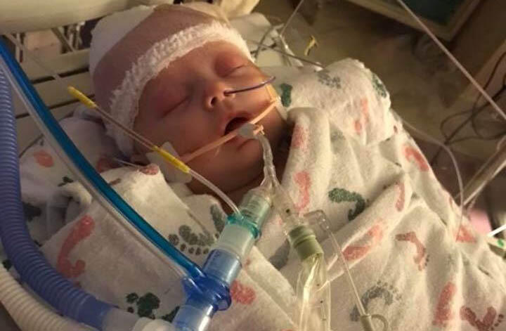 Iowa baby hit in head by softball makes small progress UPDATE - Thumbnail Image