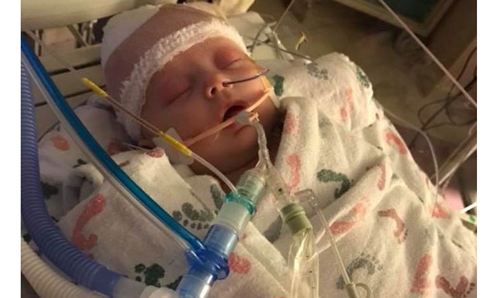 Baby McKenna - photo from Healing for McKenna on Facebook 
