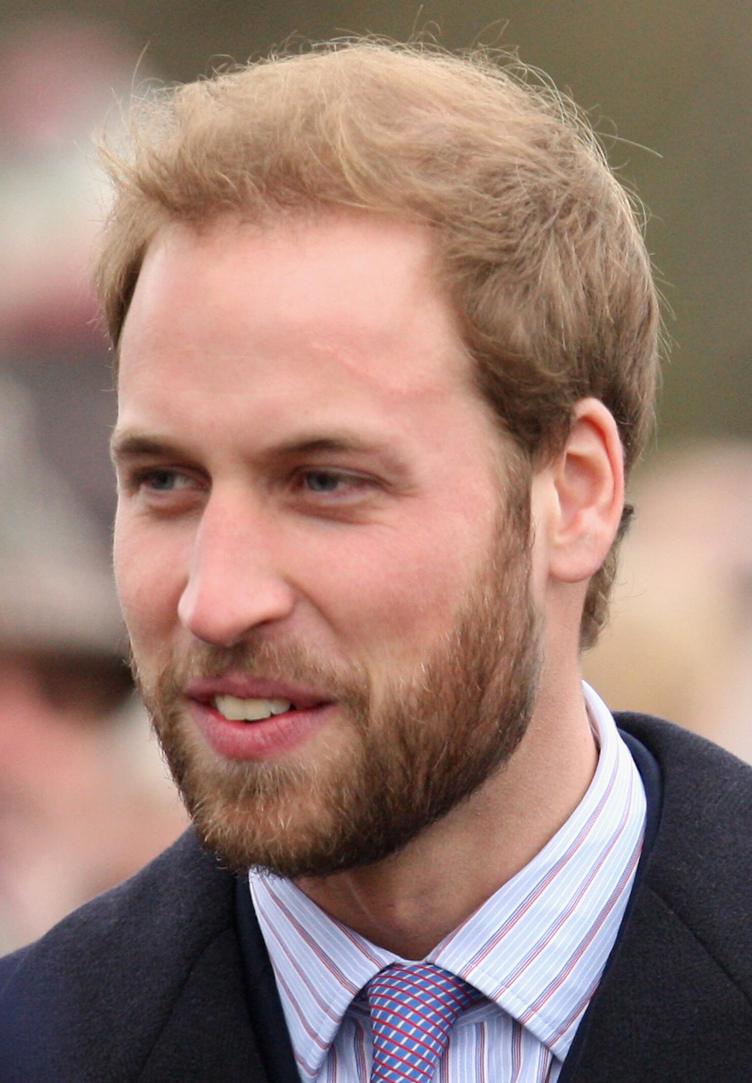 Prince William Has A Huge Scar On His Forehead iHeart