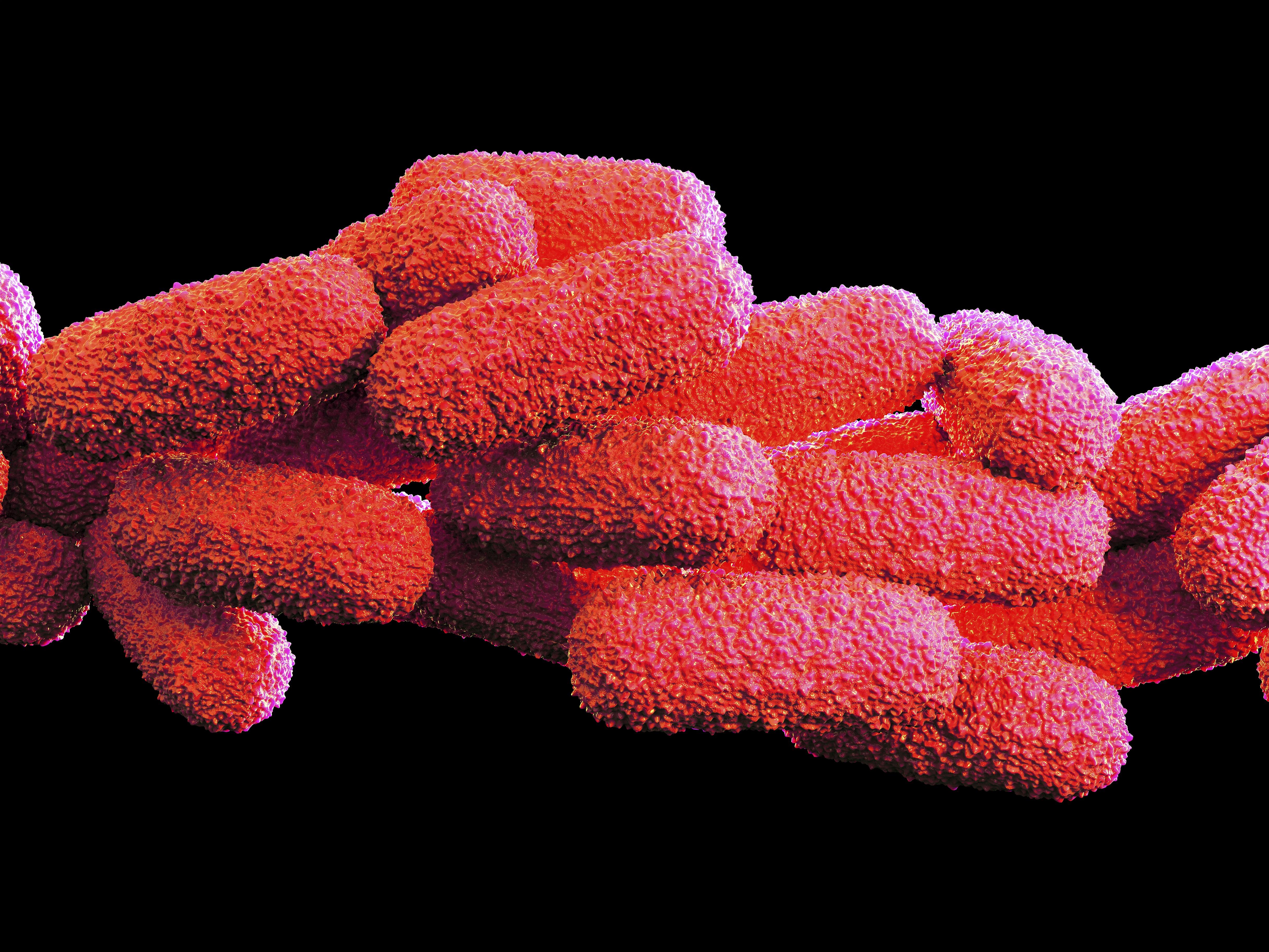 Patient at Boston VA Hospital Diagnosed With Legionnaires - Thumbnail Image