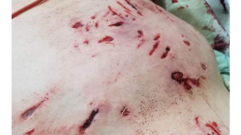 Sandra Riggin Facebook post about attack