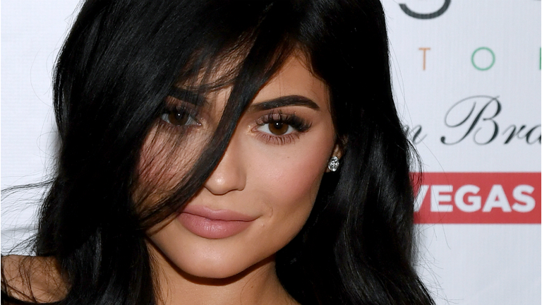 kylie-jenner-lip-fillers