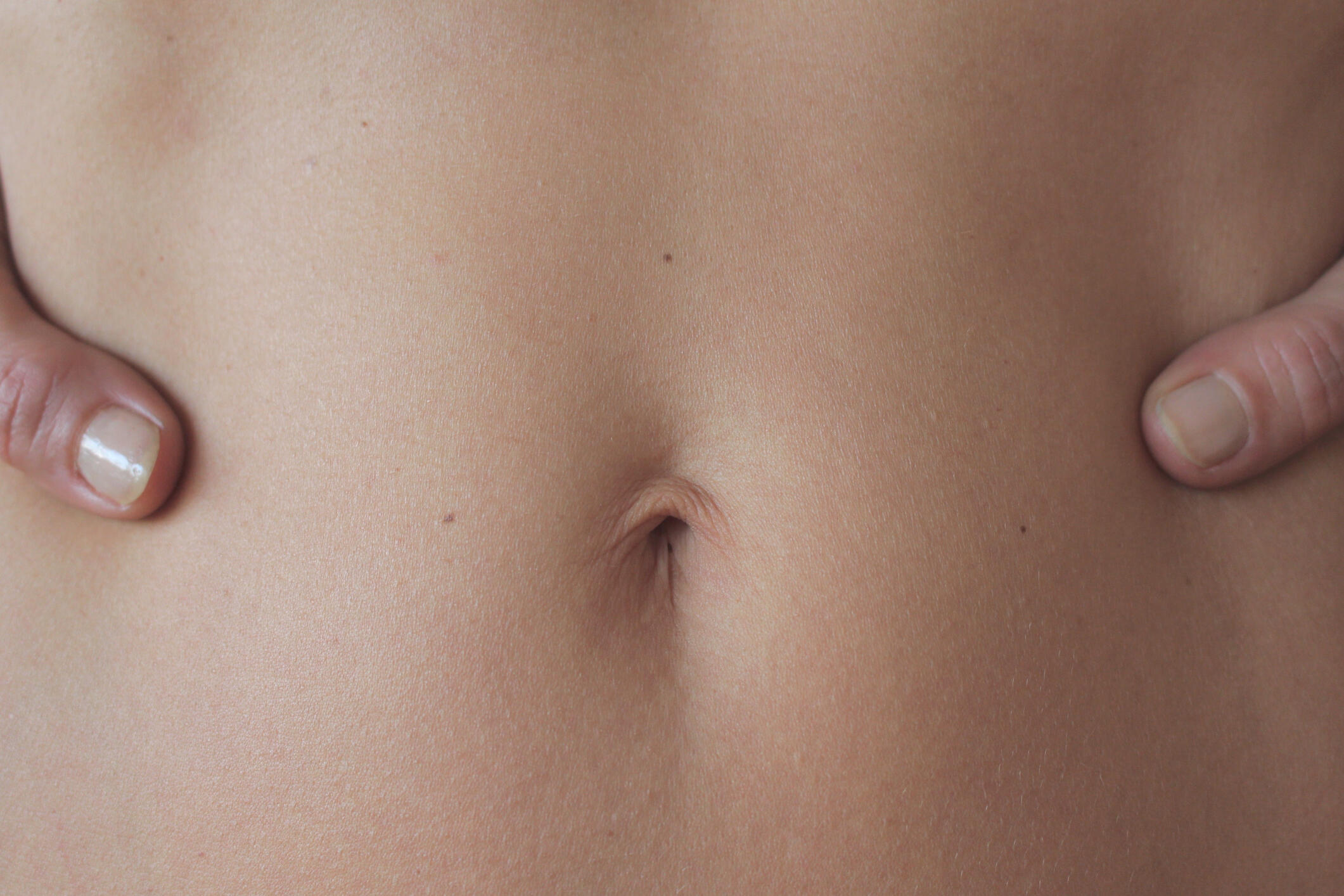 woman-gets-belly-button-removed-gives-it-to-her-boyfriend-as-a-gift