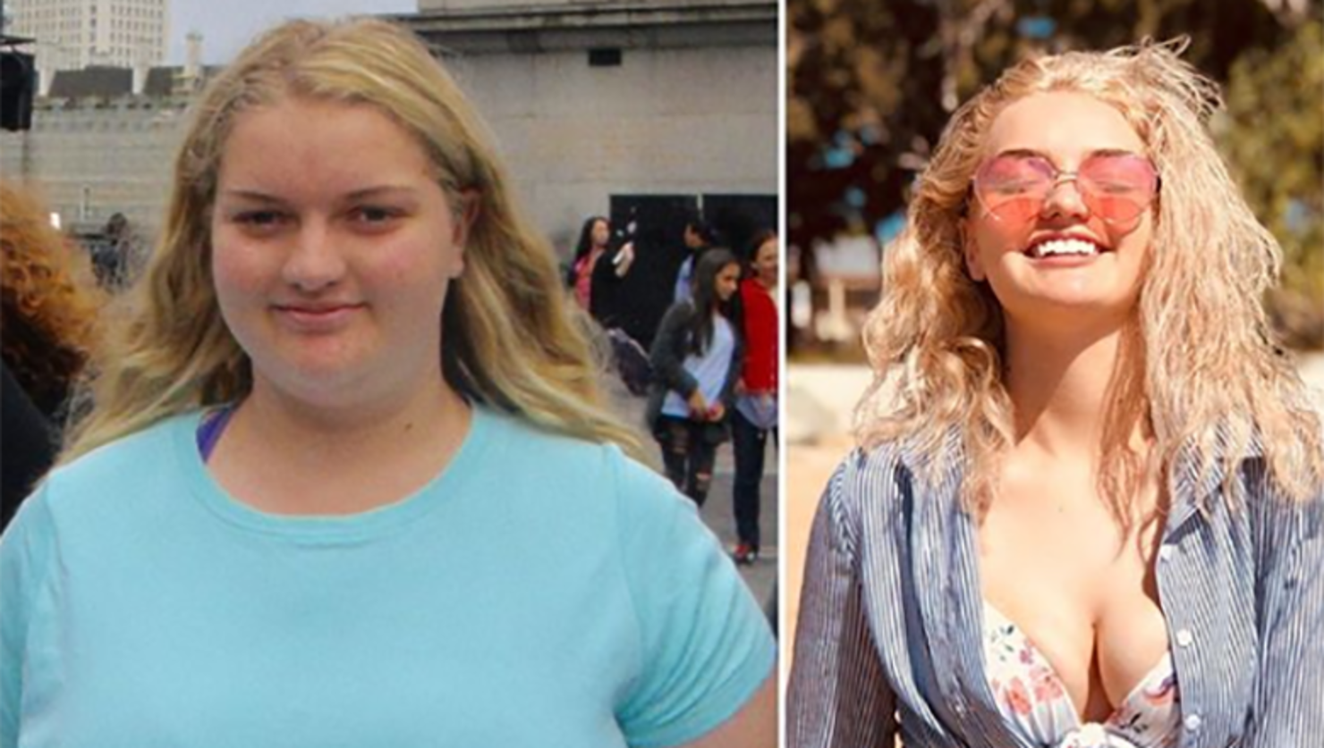 Pin on weight loss before and after