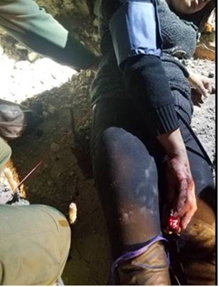 woman impales herself on fence