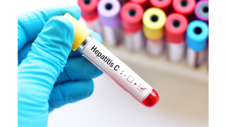 Hepatitis C Getty RF