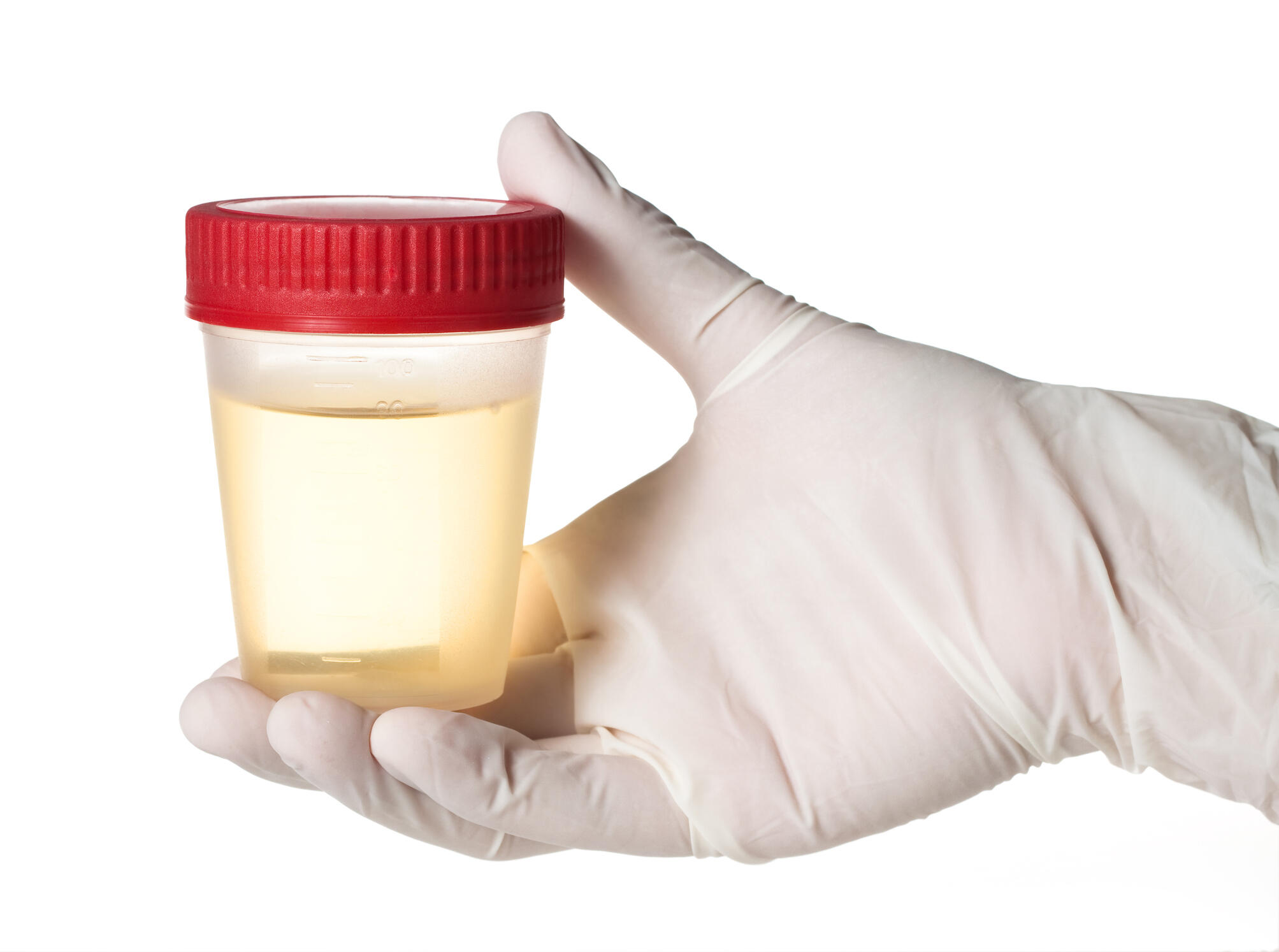 Drinking Urine Is The Latest Health Craze Bobby Bones The Bobby