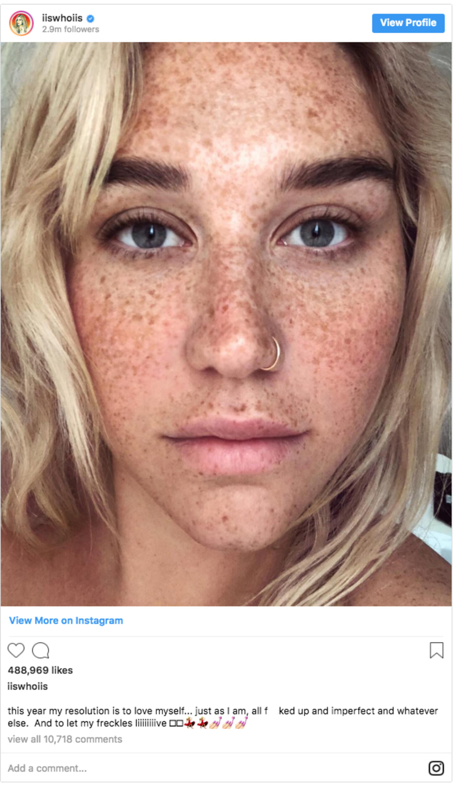Kesha In Makeup-Free Selfie To Show Off See Her Post | iHeart