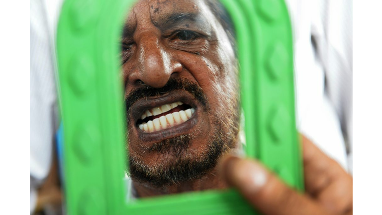 INDIA-HEALTH-DENTISTRY