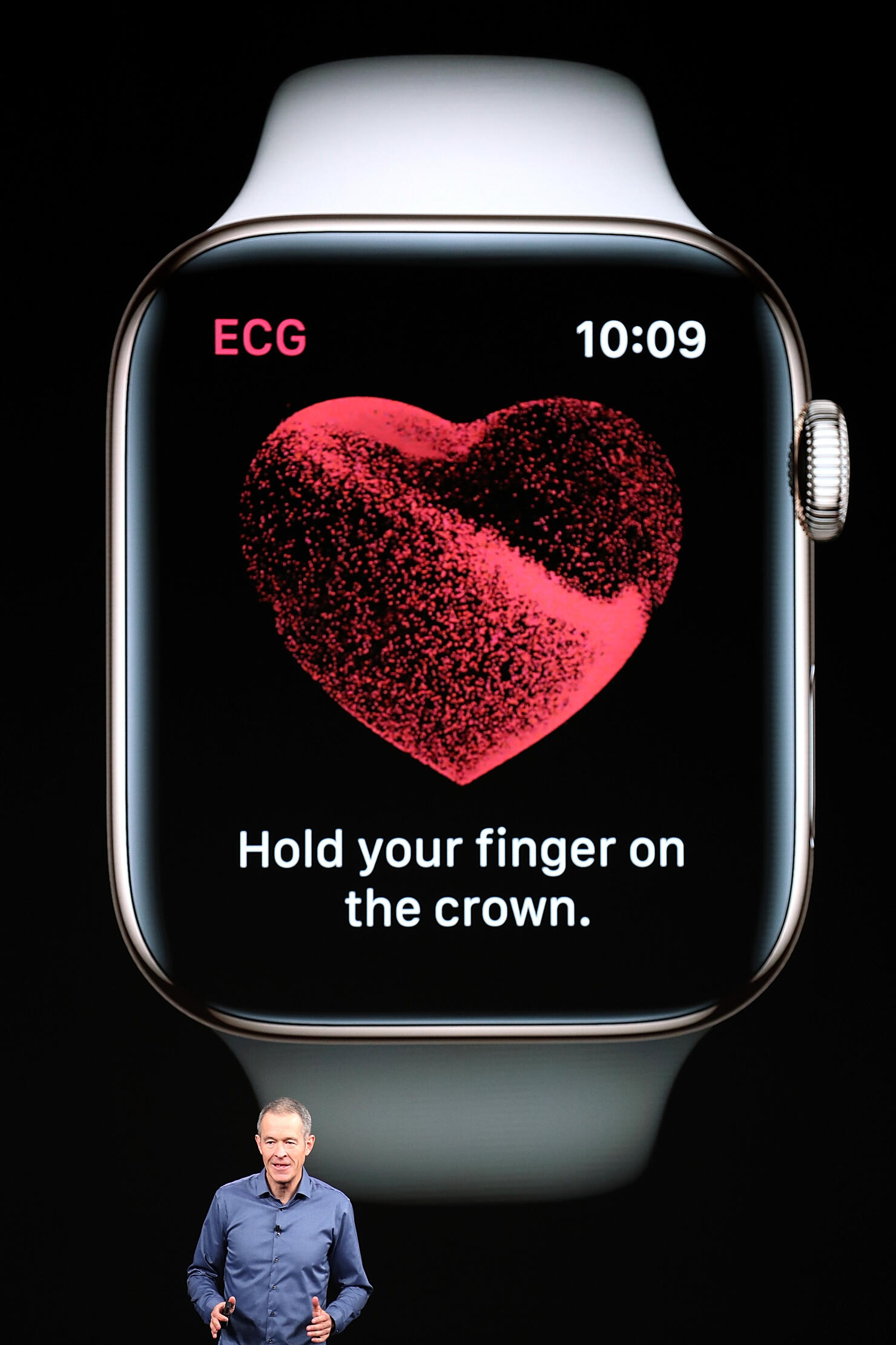 Apple Watch study finds irregular heartbeats 