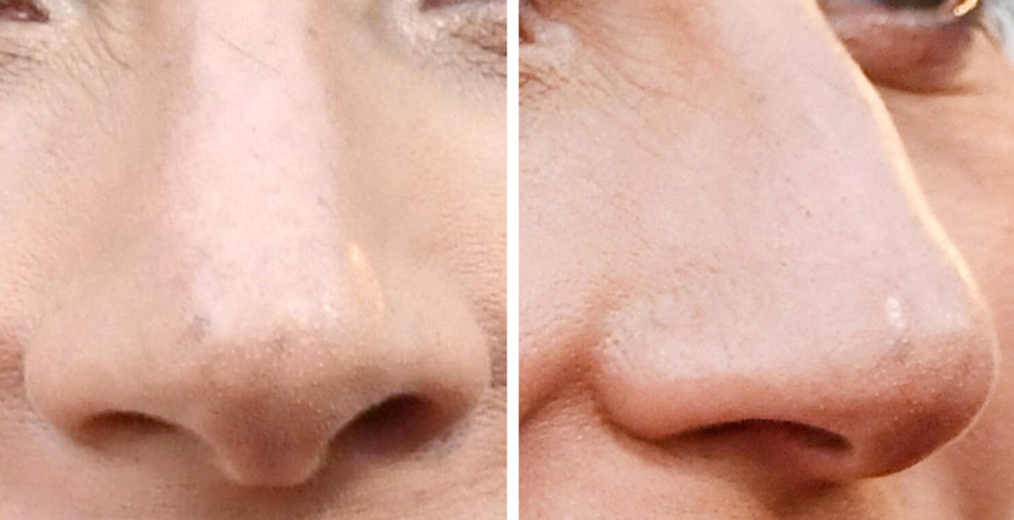 Guess The Celeb Nose! 