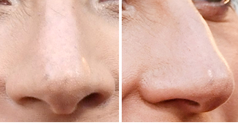 Guess The Celeb Nose! 