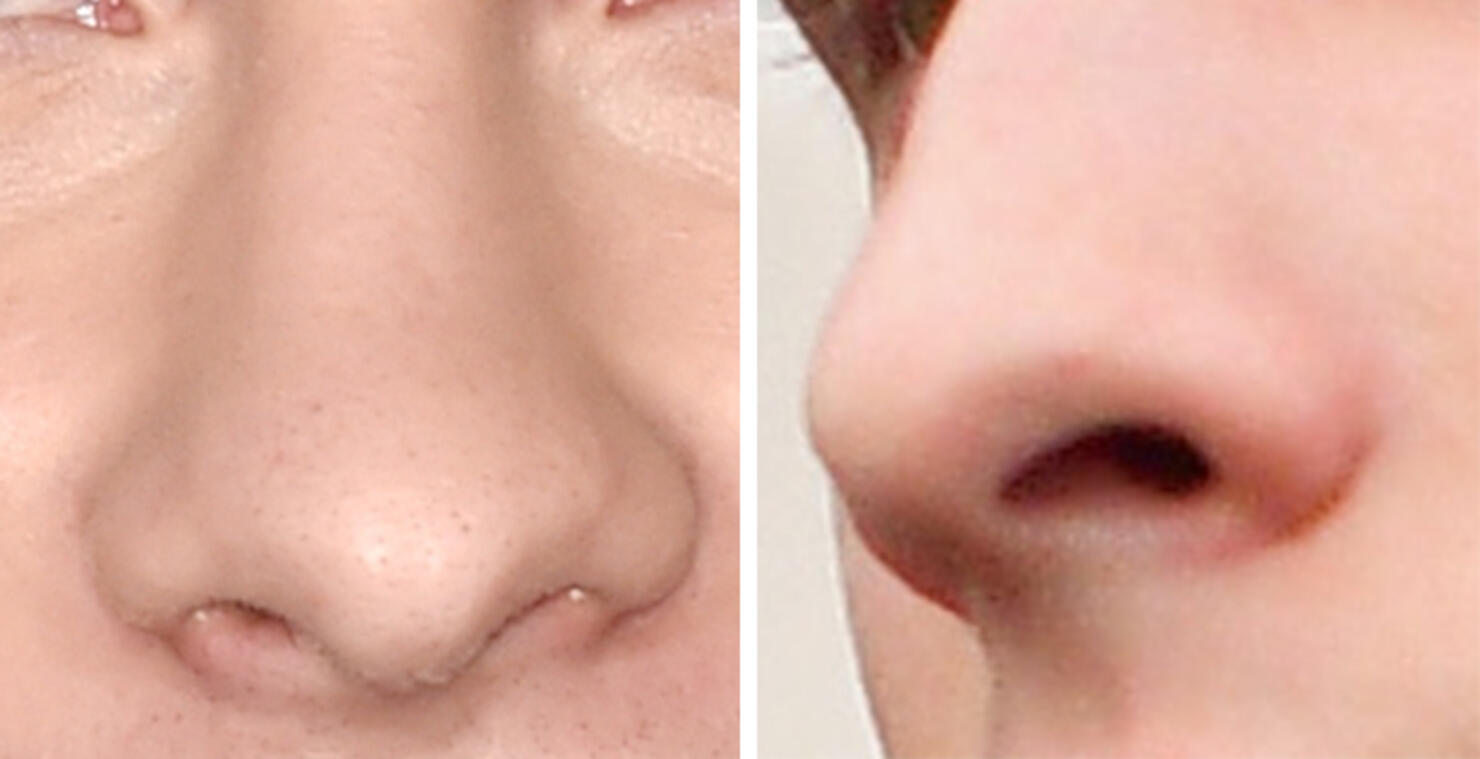 Guess The Celeb Nose!