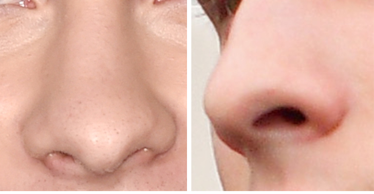 Guess The Celeb Nose!