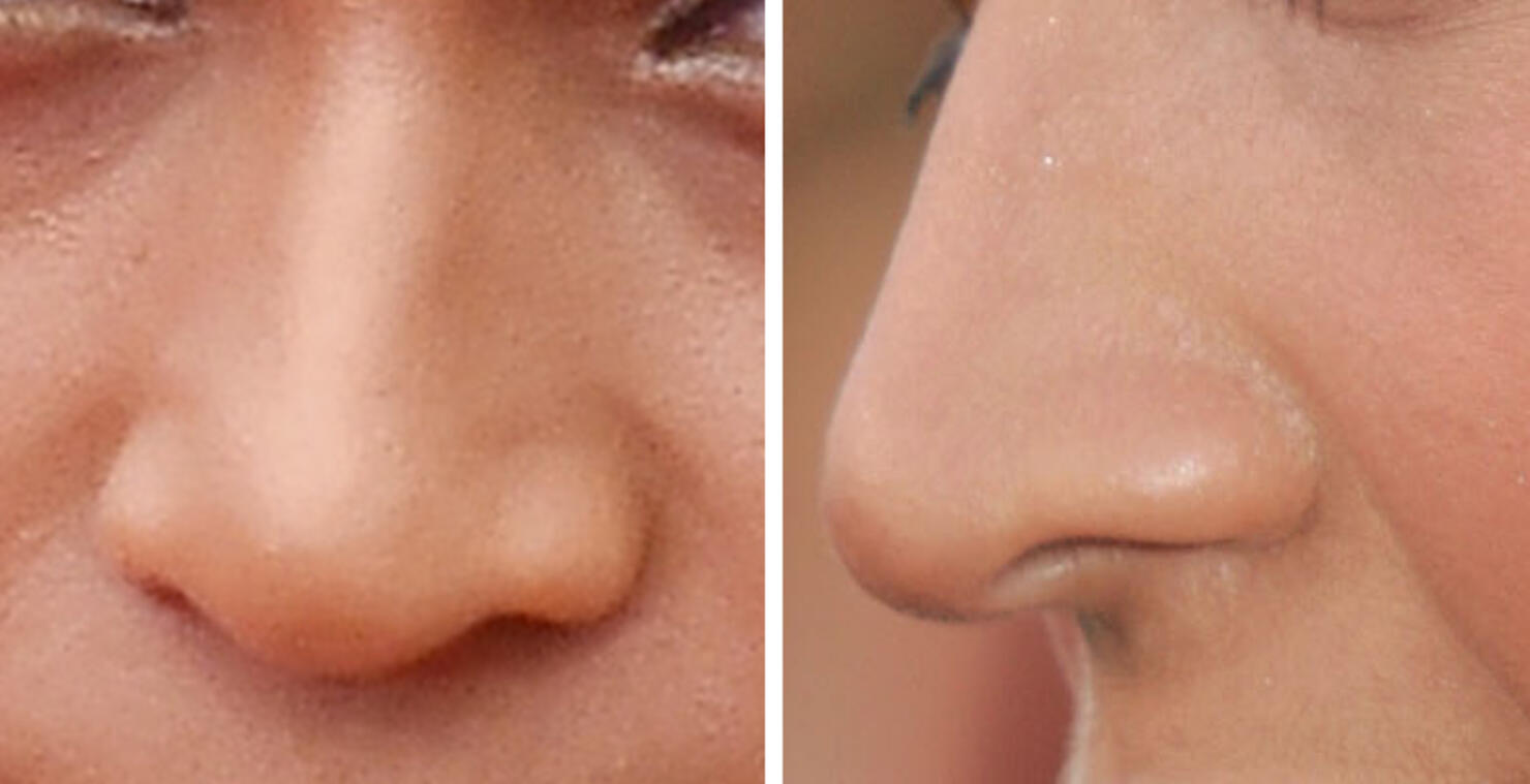 Guess The Celeb Nose!