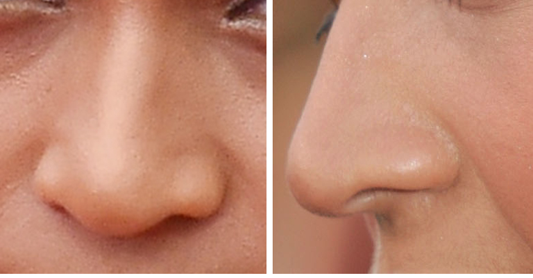 Guess The Celeb Nose!