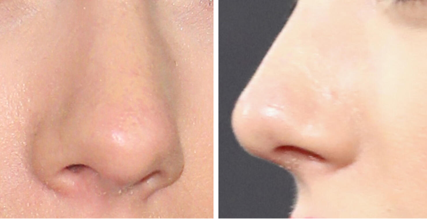 Guess The Celeb Nose!