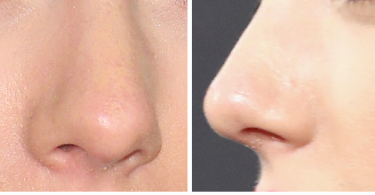 Guess The Celeb Nose!