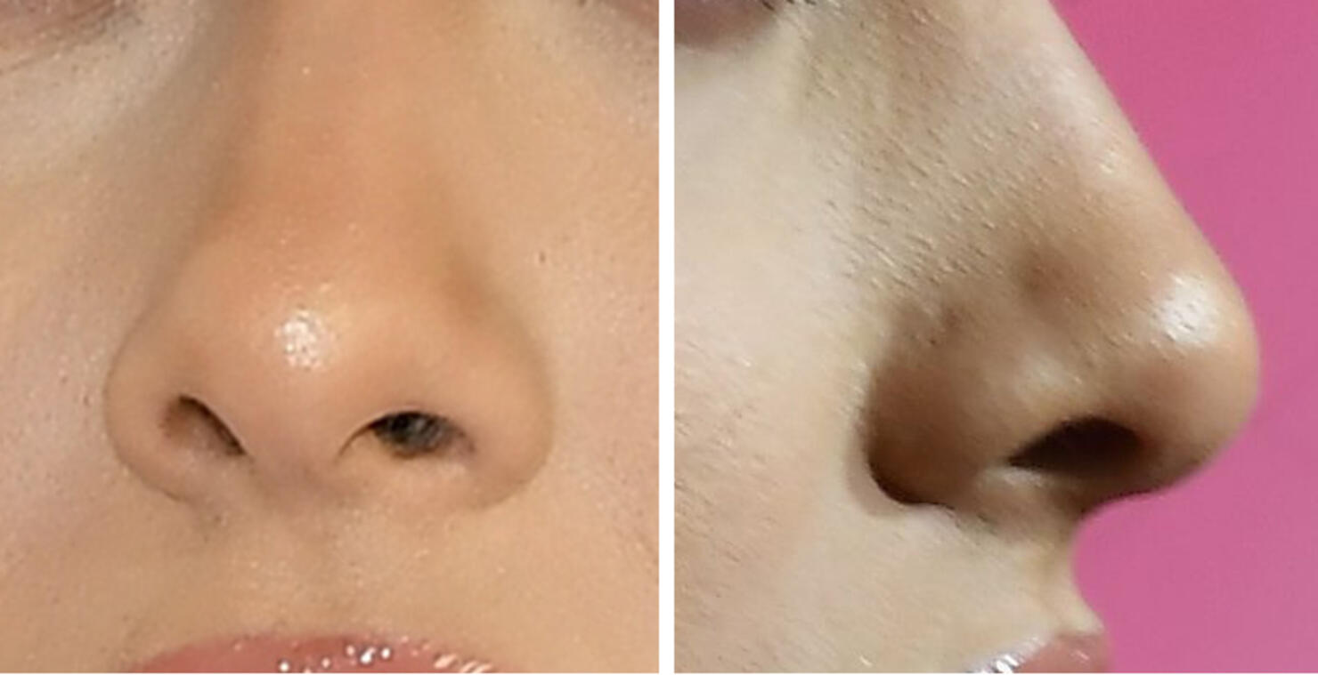 Guess The Celeb Nose!
