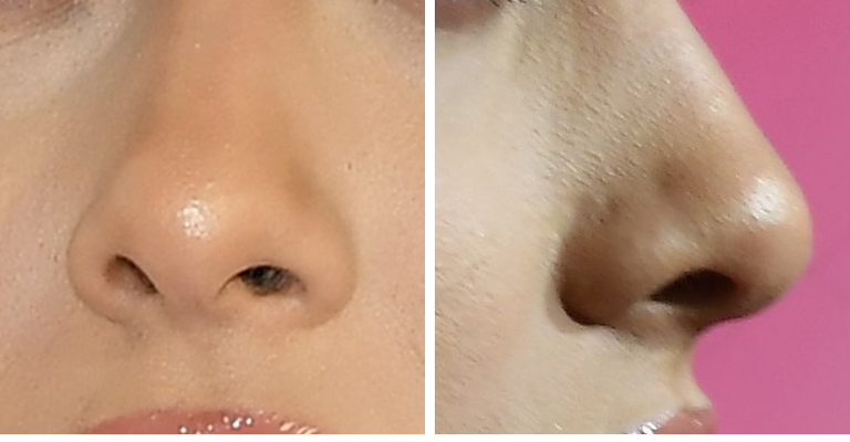 Guess The Celeb Nose!