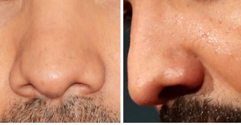 Guess The Celeb Nose!