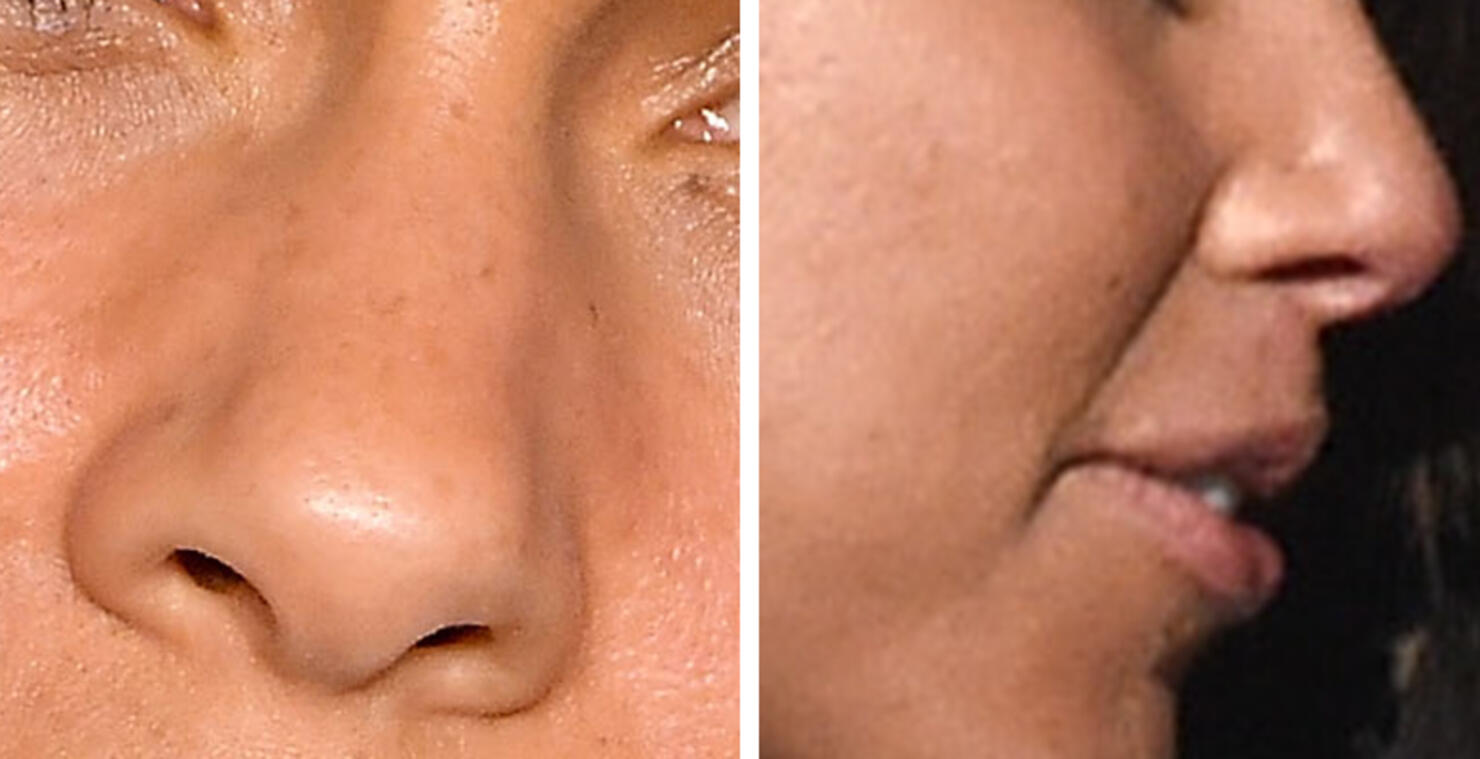 Guess The Celeb Nose!