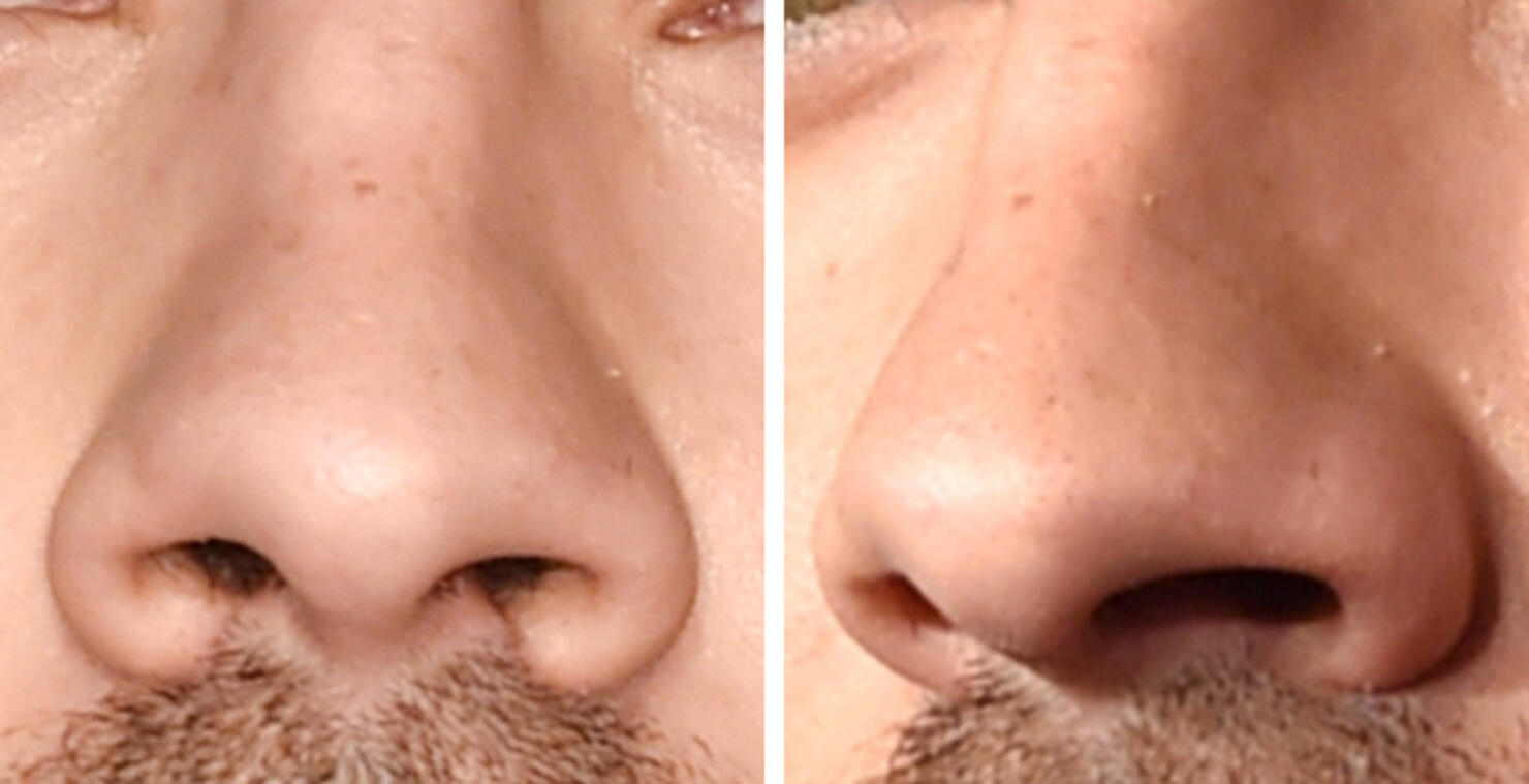 Guess The Celeb Nose!