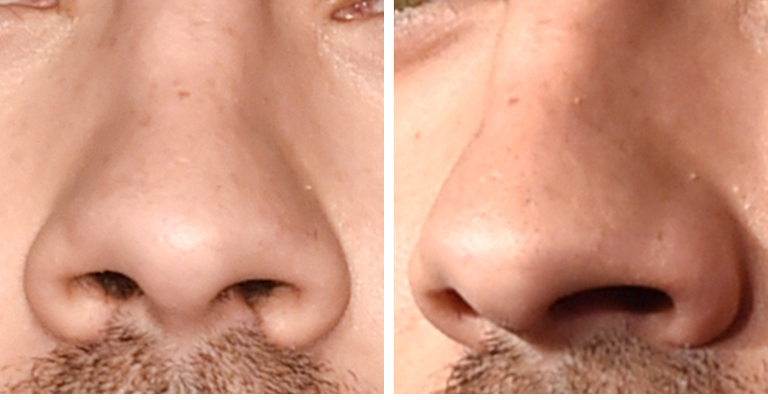 Guess The Celeb Nose!