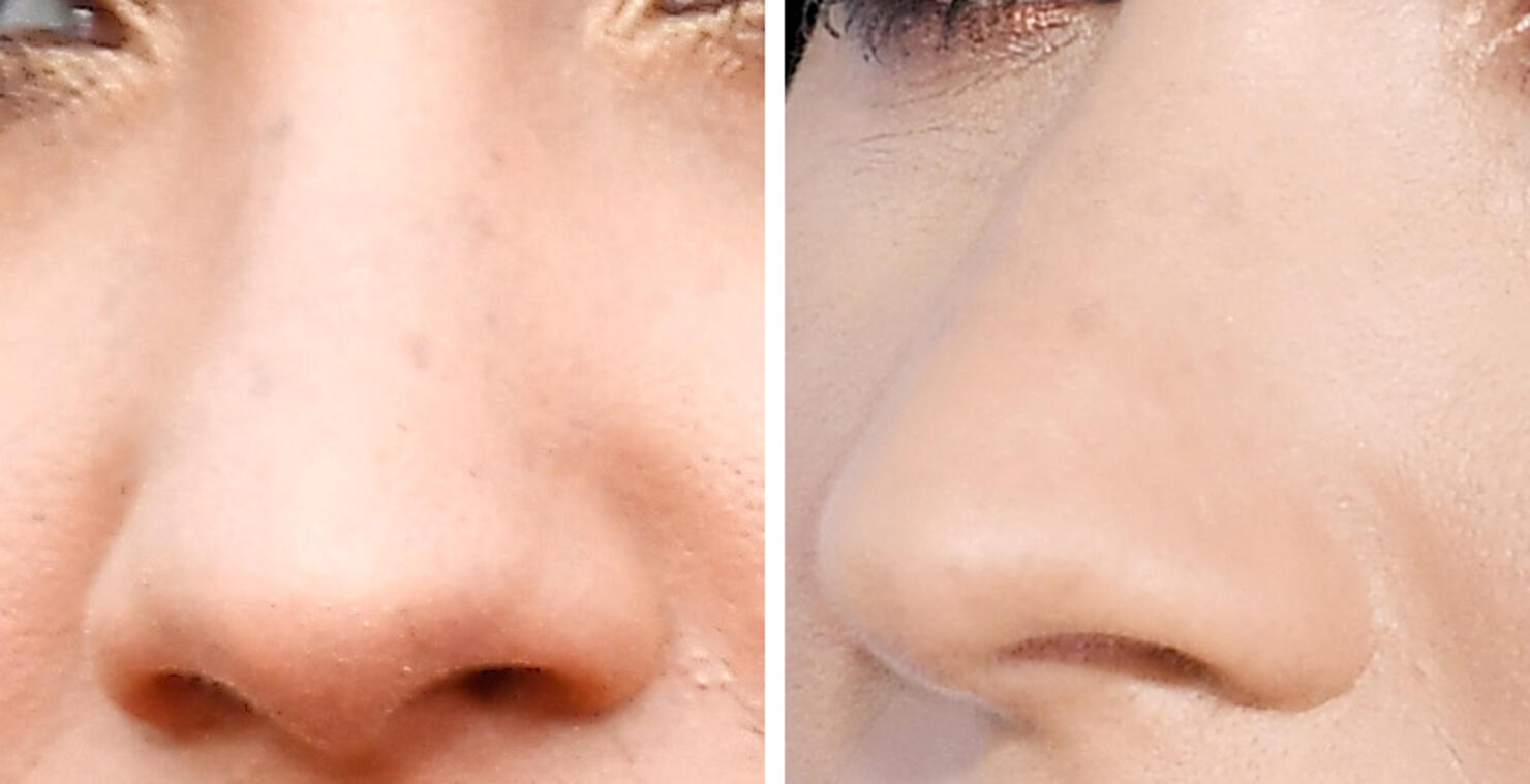 Guess The Celeb Nose!